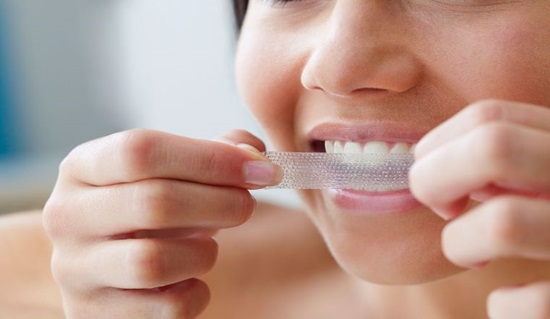 Tẩy trắng răng bằng cách sử dụng miếng dán
